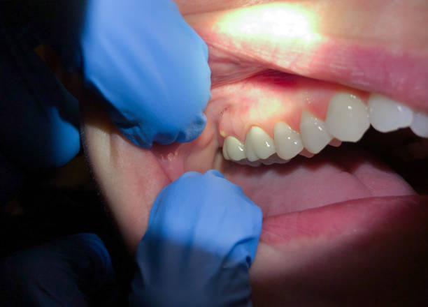 Best Orthodontic Emergency Dentist in North Richmond, CA
